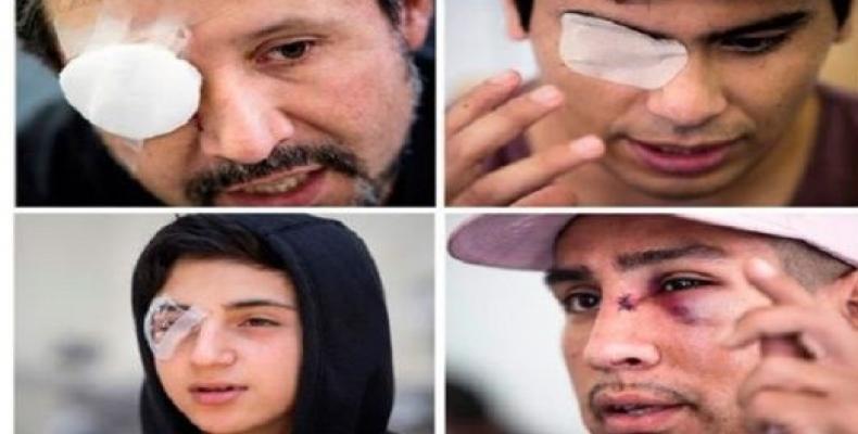 At least 270 Chileans have been wounded in the eyes as a result of Carabineros shooting directly in the face  (Photo:teleSUR)